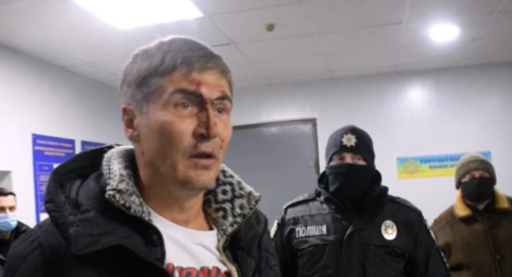 Экс-нардепа из Николаева поймали пьяным за рулем: подробности скандала